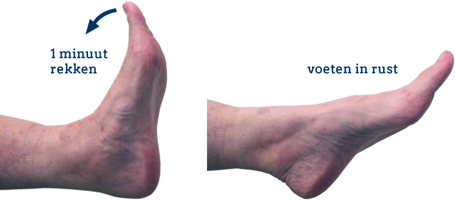 Rekoefening voor het herstel van een ontstoken peesplaat onder de knie